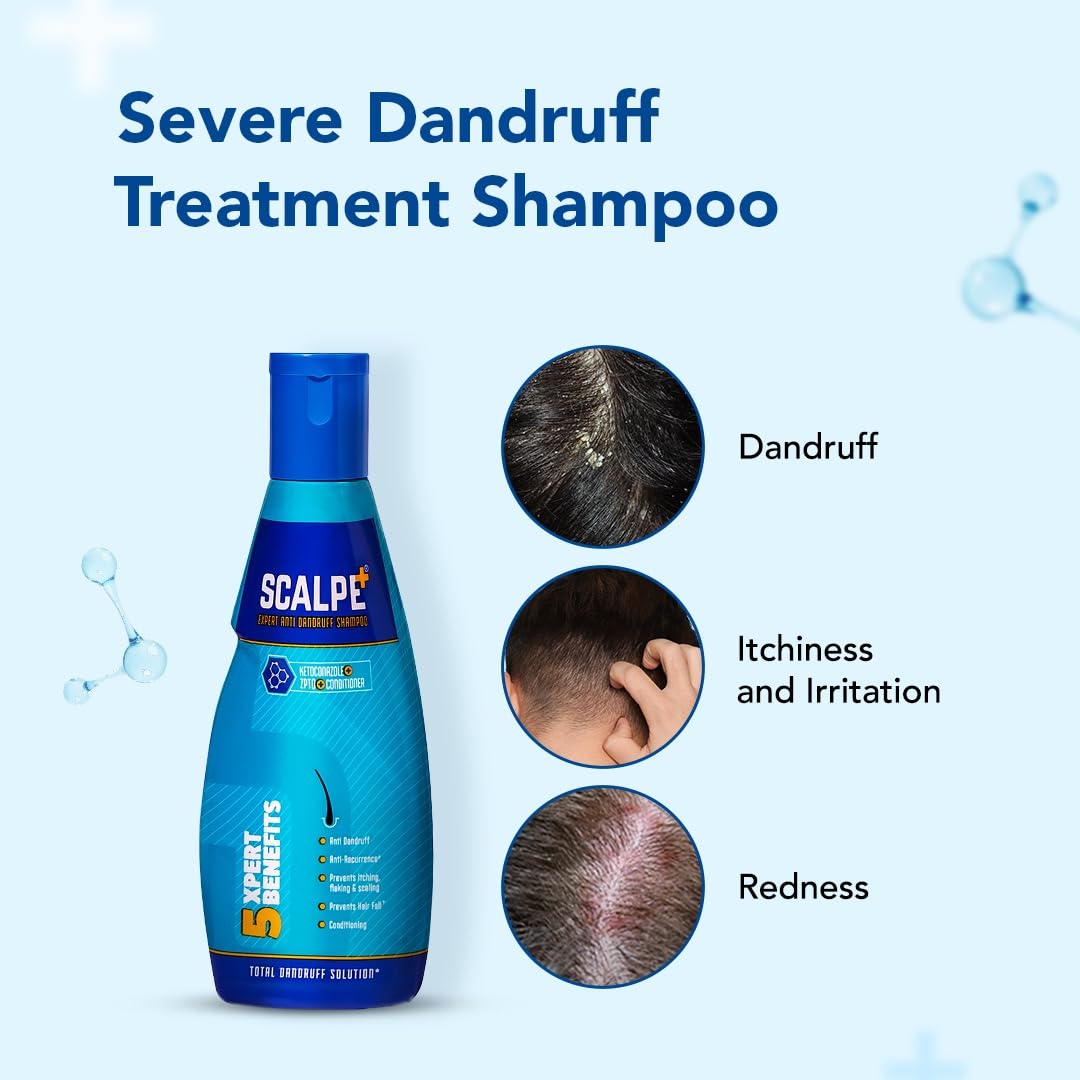 Scalpe+ Expert - Bottle of 75ml Anti Dandruff Shampoo for Men and Women with Ketoconazole and ZPTO